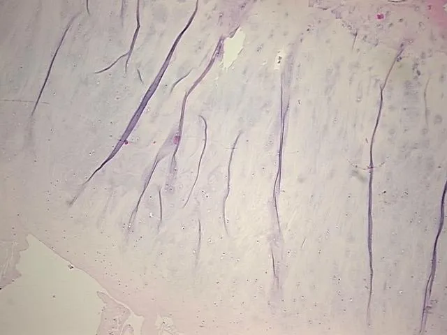 Tissue FFPE Sections, Joint - image 1