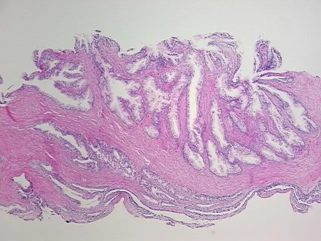 Tissue FFPE Sections, Prostate - image 1