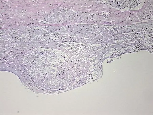 Tissue FFPE Sections, Neural tissue - image 1