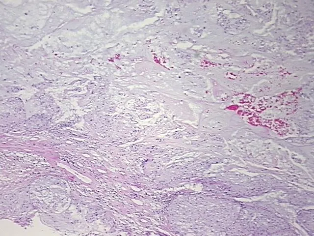 Tissue FFPE Sections, Neural tissue - image 1