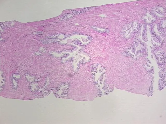 Tissue FFPE Sections, Prostate - image 1