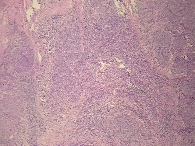 Tissue FFPE Sections, Cervix - image 1