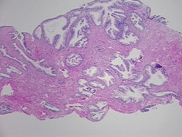 Tissue FFPE Sections, Prostate - image 1