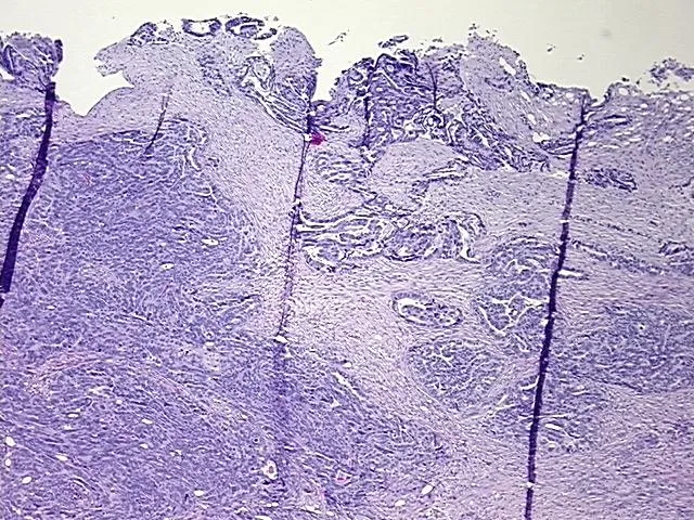 Tissue FFPE Sections, Ovary: bilateral - image 1