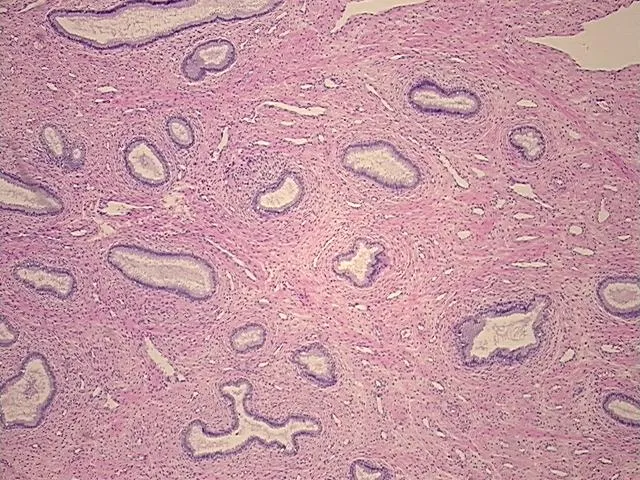 Tissue FFPE Sections, Cervix - image 1