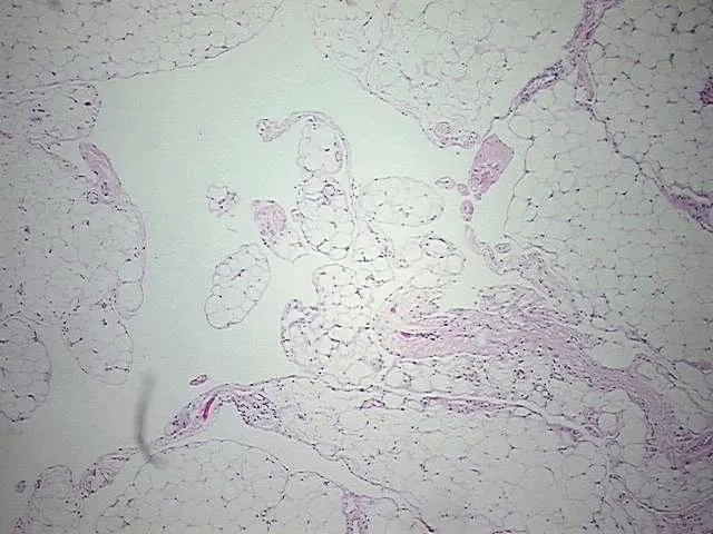 Tissue FFPE Sections, Adipose tissue - image 1