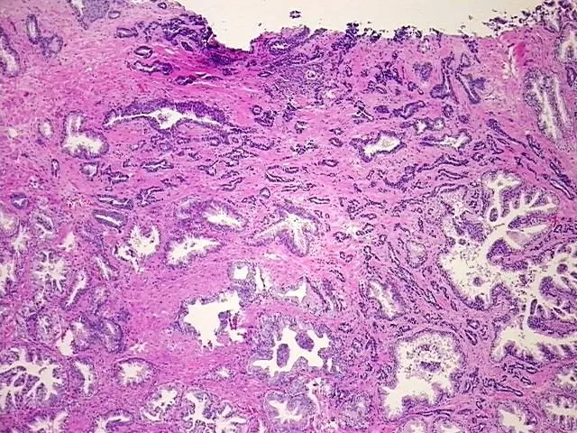 Tissue FFPE Sections, Prostate - image 1