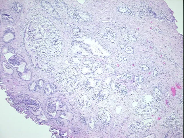 Tissue FFPE Sections, Prostate - image 1