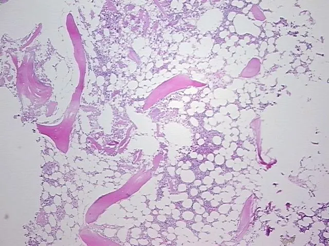 Tissue FFPE Sections, Bone - image 1