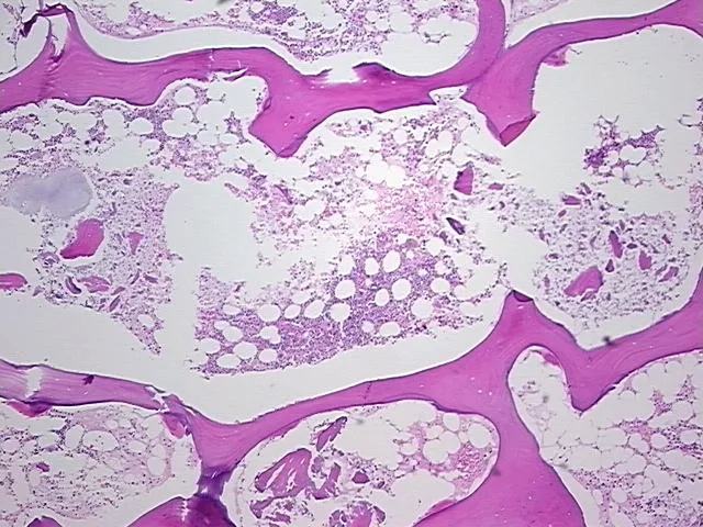 Tissue FFPE Sections, Bone - image 1