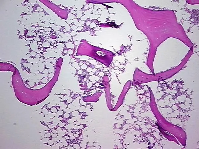 Tissue FFPE Sections, Bone - image 1