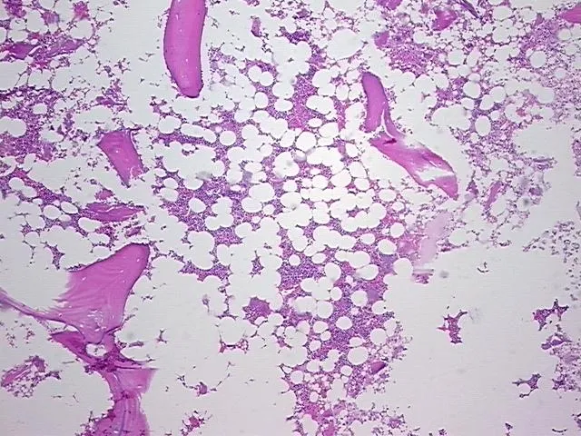 Tissue FFPE Sections, Bone - image 1