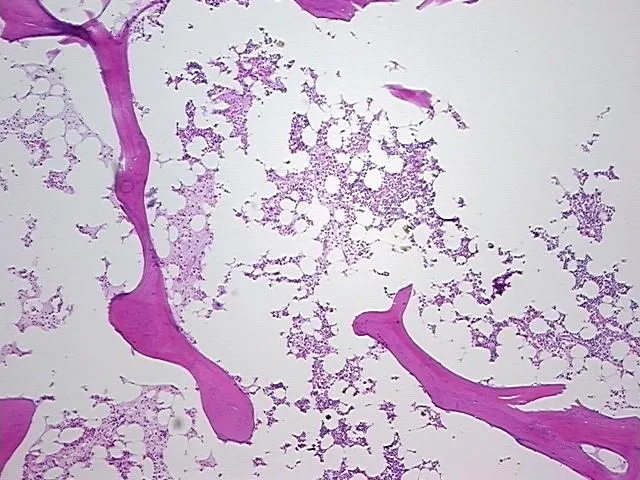 Tissue FFPE Sections, Bone - image 1
