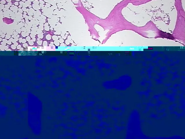Tissue FFPE Sections, Bone - image 1
