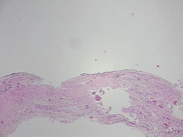 Tissue FFPE Sections, Paratubal tissue - image 1