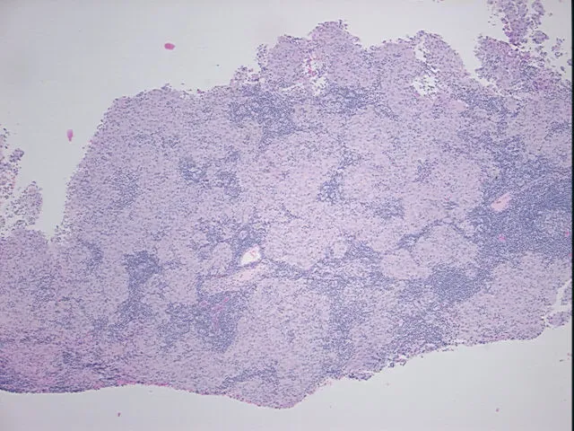 Tissue FFPE Sections, Lymph node - image 1