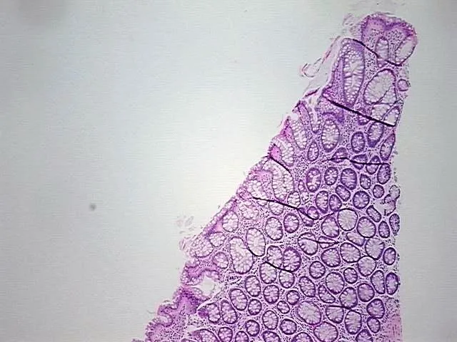 Tissue FFPE Sections, Rectum - image 1