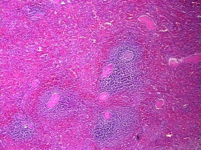 Tissue FFPE Sections, Spleen - image 1