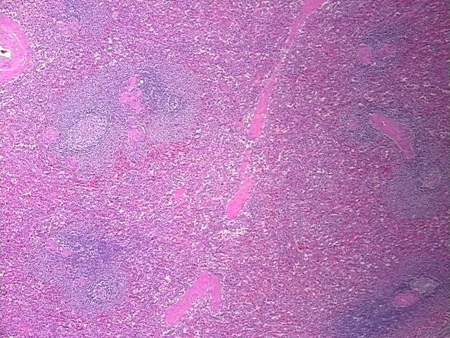 Tissue FFPE Sections, Spleen - image 1
