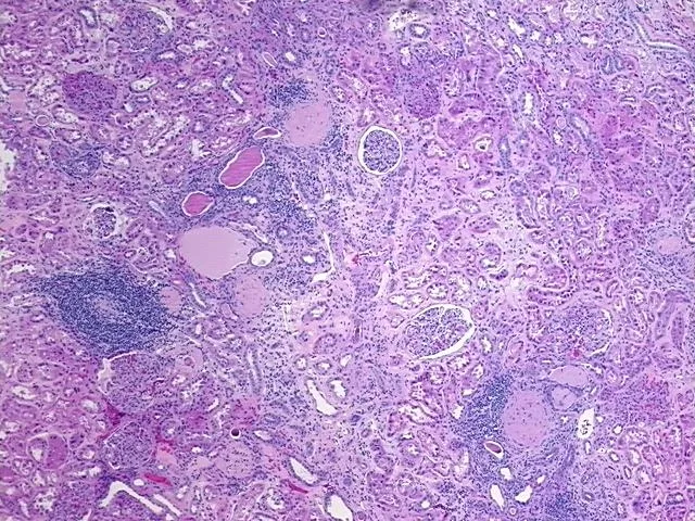 Tissue FFPE Sections, Kidney - image 1