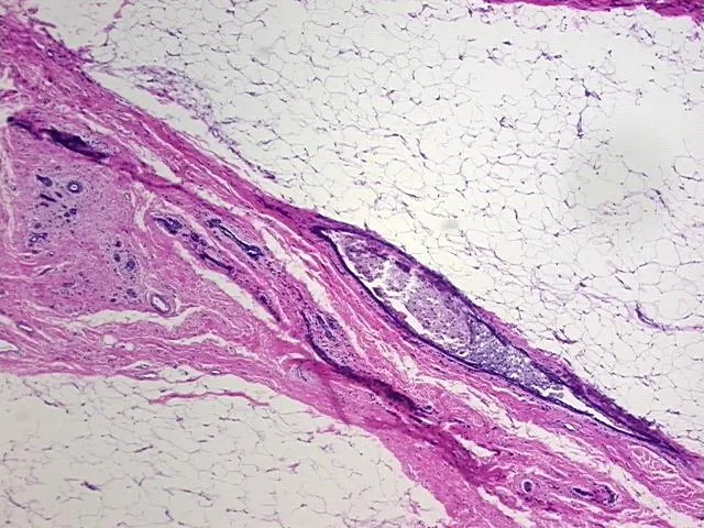 Tissue FFPE Sections, Breast - image 1