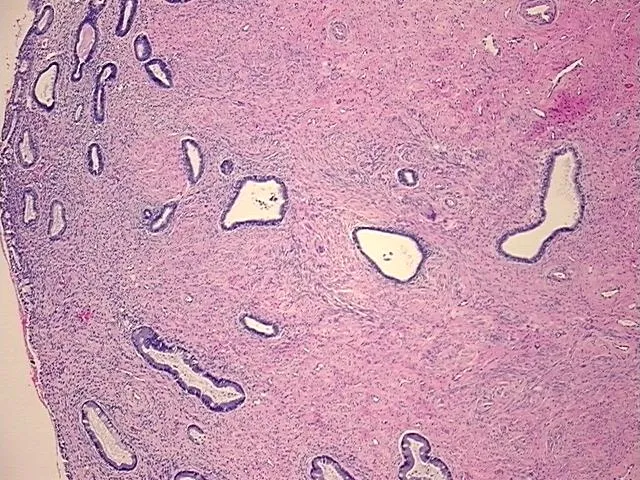 Tissue FFPE Sections, Uterus, lower segment - image 1