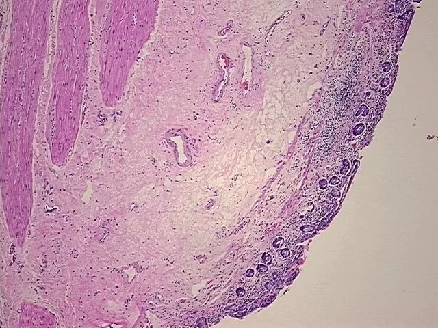 Tissue FFPE Sections, Small intestine - image 1
