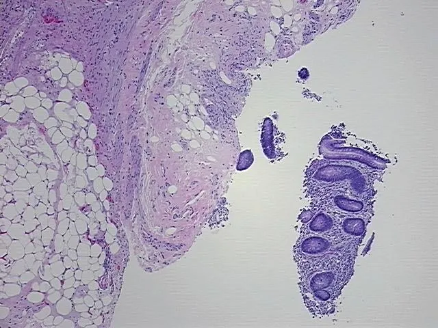 Tissue FFPE Sections, Appendix - image 1