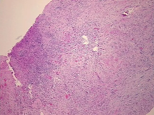 Tissue FFPE Sections, Esophagus - image 1