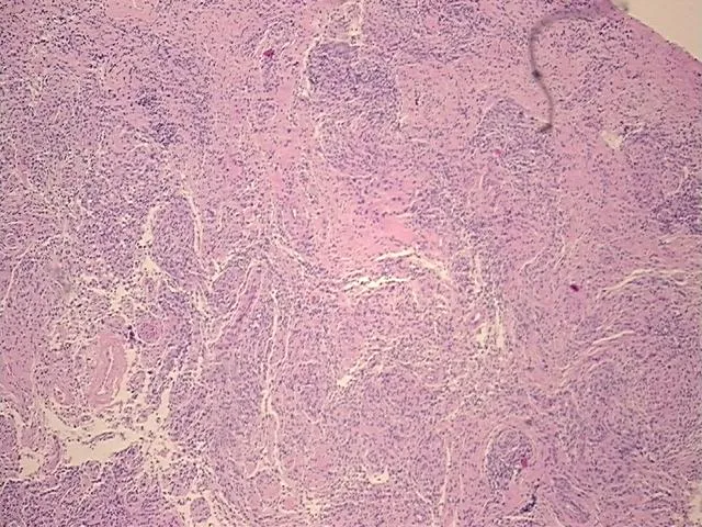 Tissue FFPE Sections, Brain - image 1