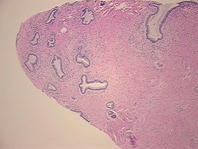 Tissue FFPE Sections, Cervix - image 1