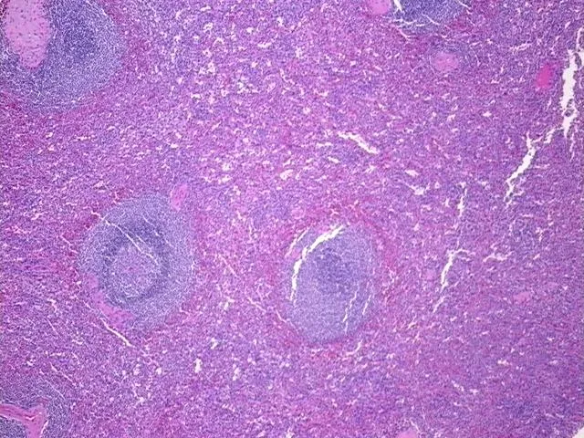 Tissue FFPE Sections, Spleen - image 1