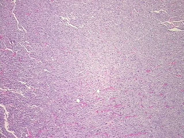 Tissue FFPE Sections, Soft tissue - image 1