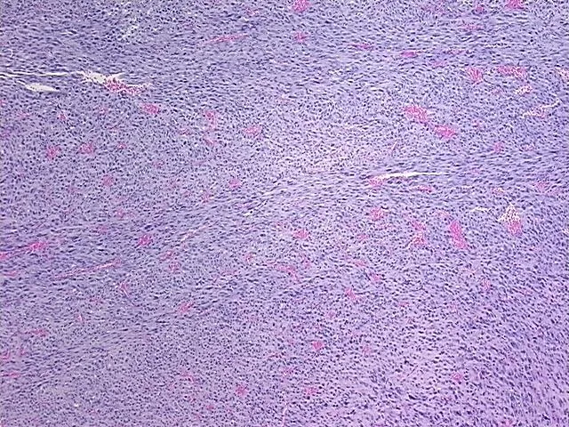 Tissue FFPE Sections, Soft tissue - image 1