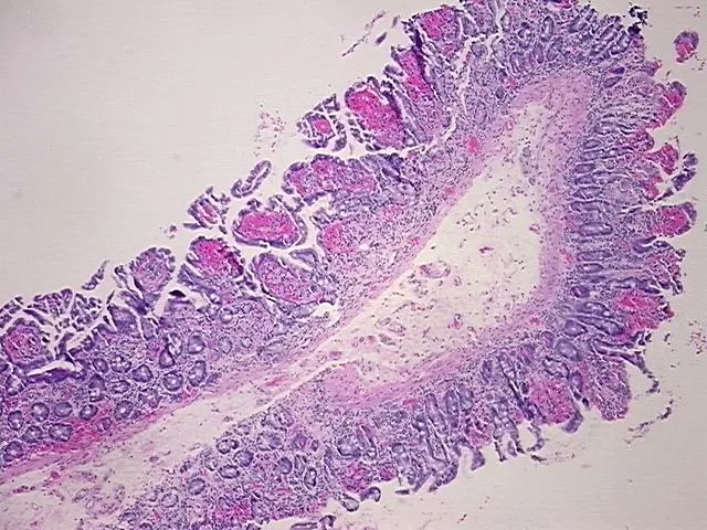 Tissue FFPE Sections, Duodenum - image 1
