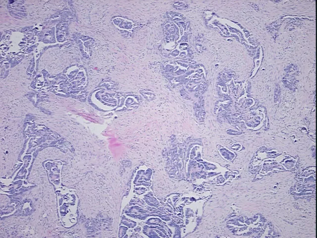 Tissue FFPE Sections, Omentum - image 1