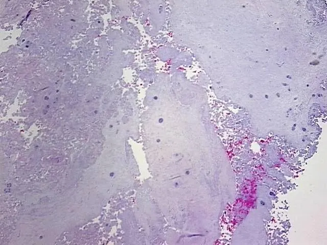 Tissue FFPE Sections, Intervertebral disc - image 1