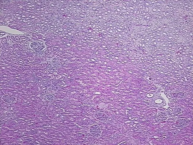 Tissue FFPE Sections, Kidney - image 1