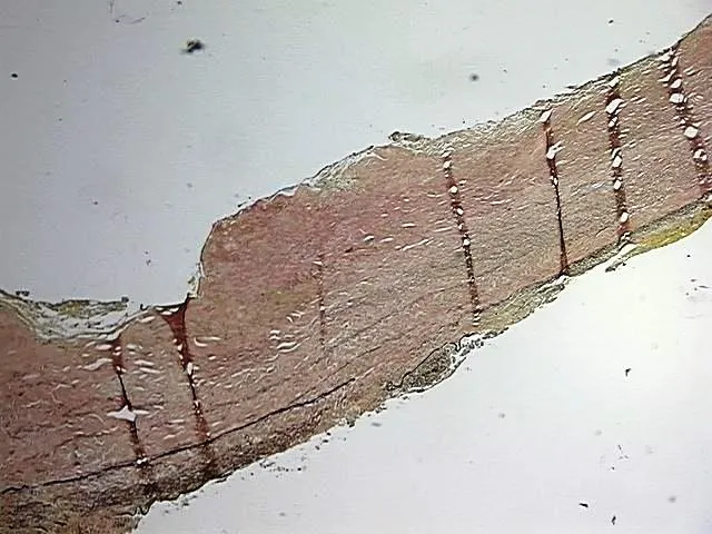 Tissue FFPE Sections, Aorta - image 1