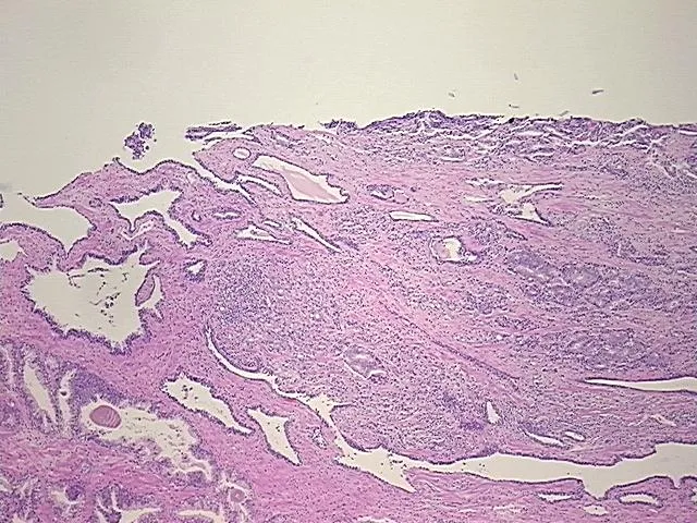 Tissue FFPE Sections, Prostate - image 1