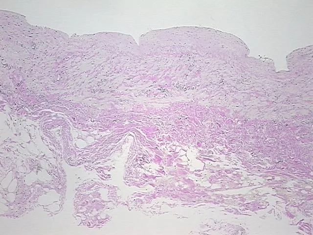 Tissue FFPE Sections, Vein - image 1