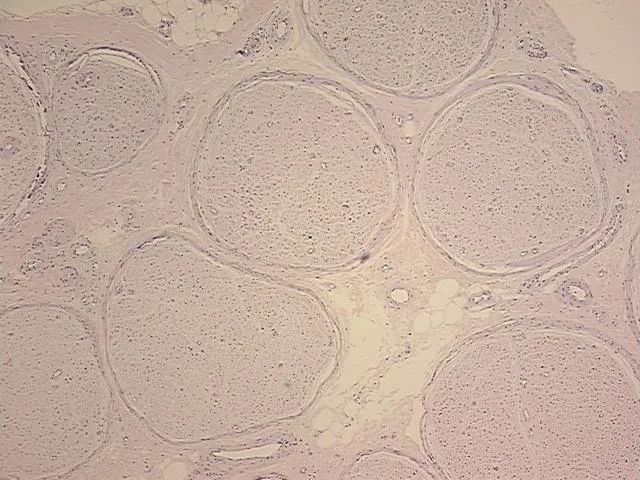 Tissue FFPE Sections, Peripheral nerve - image 1