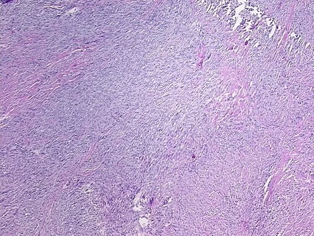 Tissue FFPE Sections, Soft tissue - image 1