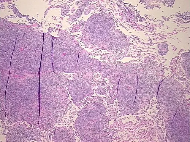 Tissue FFPE Sections, Lymphoid tissue - image 1