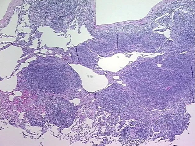 Tissue FFPE Sections, Lymphoid tissue - image 1