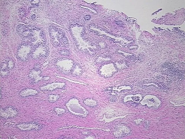 Tissue FFPE Sections, Prostate - image 1