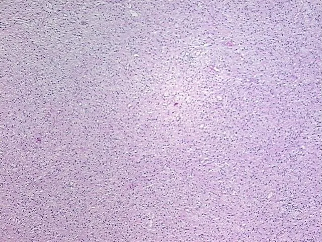 Tissue FFPE Sections, Soft tissue - image 1