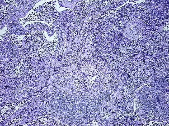 Tissue FFPE Sections, Urinary bladder - image 1