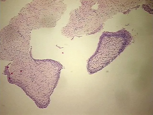 Tissue FFPE Sections, Cervix - image 1