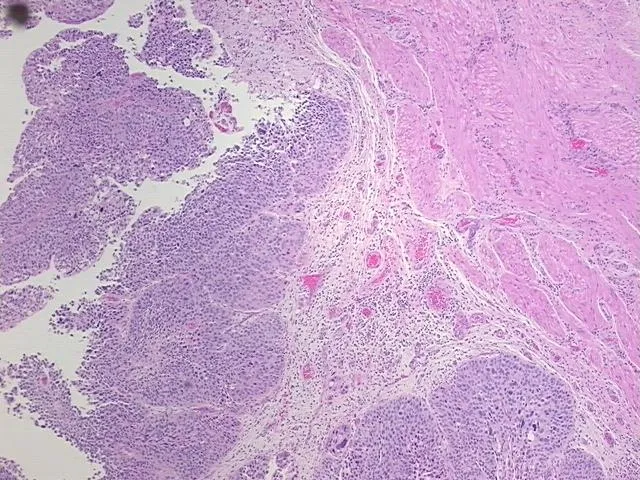Tissue FFPE Sections, Ureter - image 1